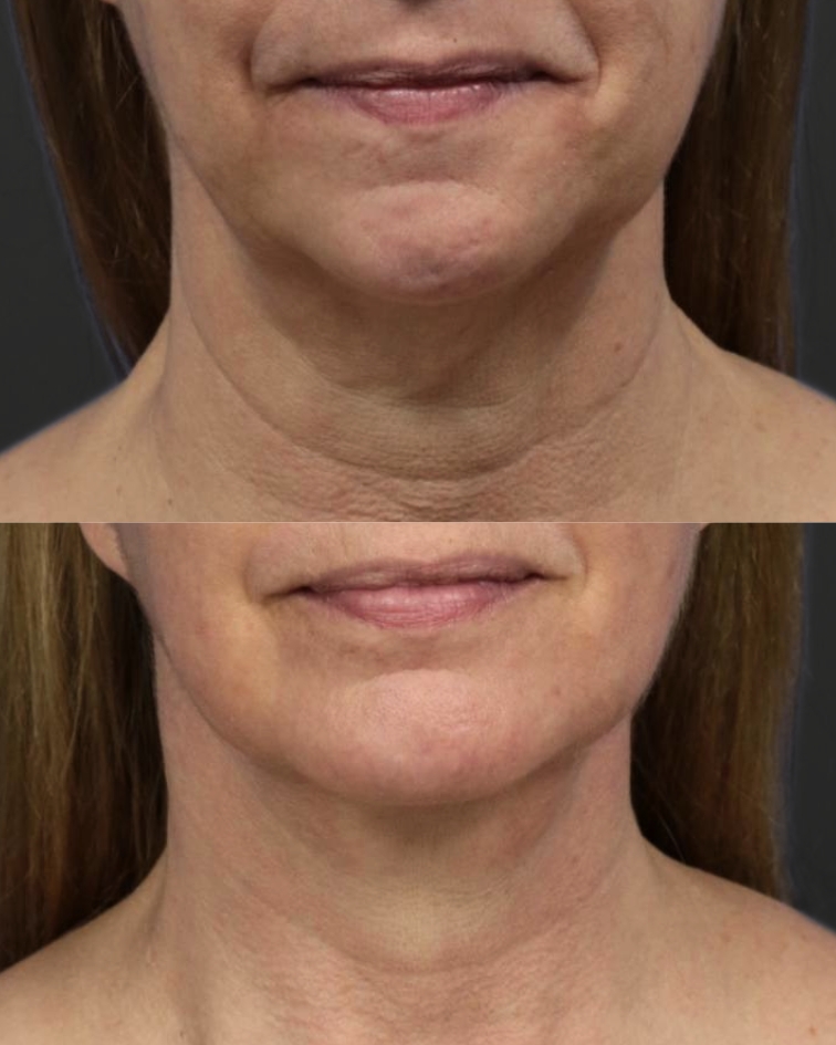 neck treatment in marquette mi