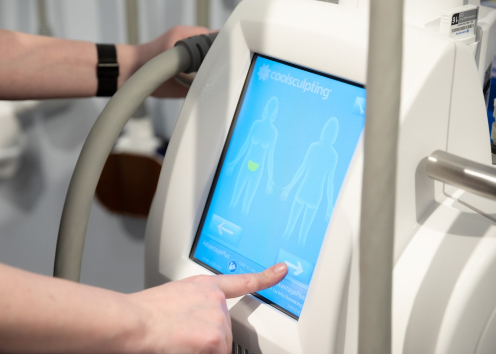 CoolSculpting in Marquette